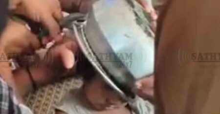 കളിക്കിടെ അലുമിനിയം പാത്രം തലയിൽ കുടുങ്ങി; നാദാപുരത്ത് രണ്ട് വയസ്സുകാരിക്ക് രക്ഷകരായി അഗ്നിരക്ഷാസേന